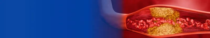Vascular Services